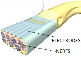 nerfs electrodes